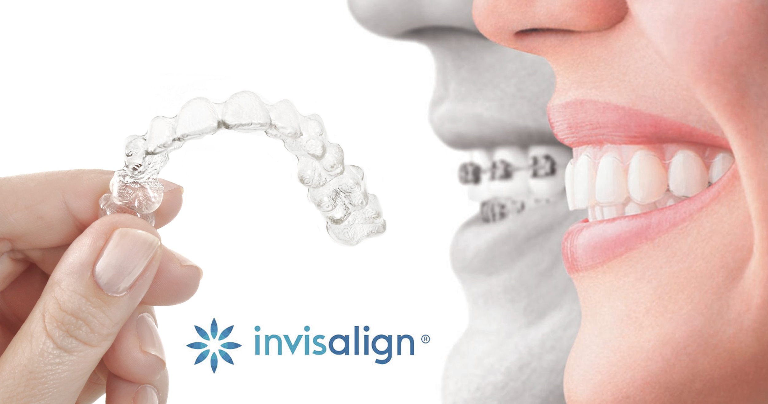 ortodoncia invisalign